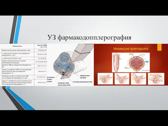 УЗ фармакодопплерография