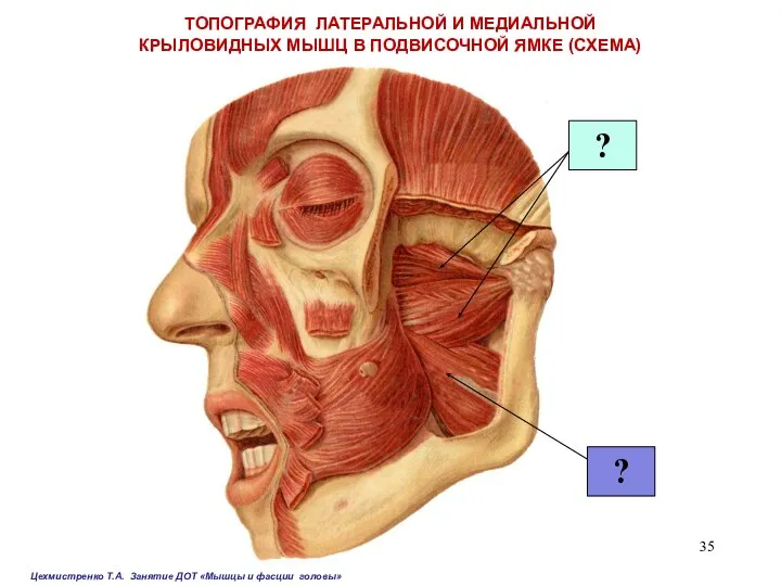 ТОПОГРАФИЯ ЛАТЕРАЛЬНОЙ И МЕДИАЛЬНОЙ КРЫЛОВИДНЫХ МЫШЦ В ПОДВИСОЧНОЙ ЯМКЕ (СХЕМА) ?