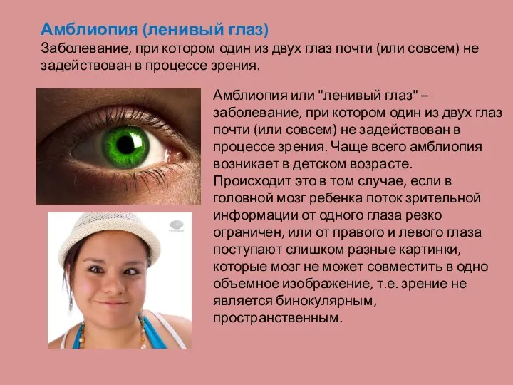 Амблиопия (ленивый глаз) Заболевание, при котором один из двух глаз почти