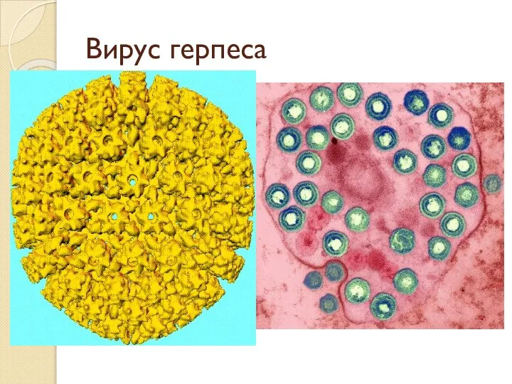 Вирус герпеса