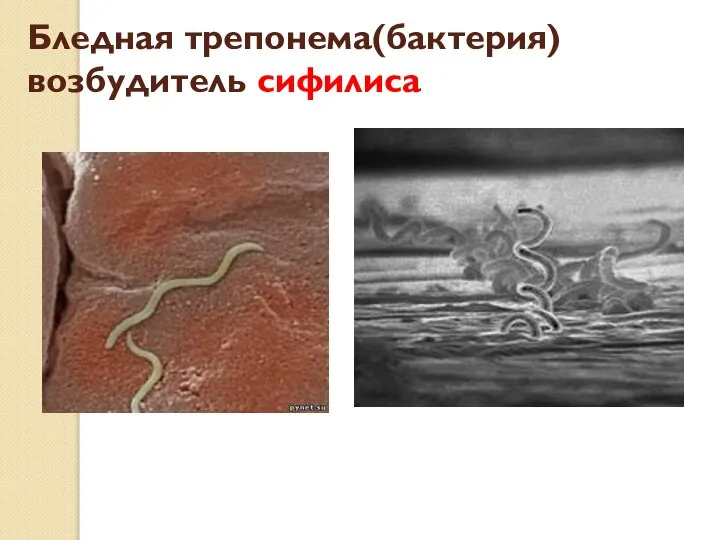 Бледная трепонема(бактерия) возбудитель сифилиса