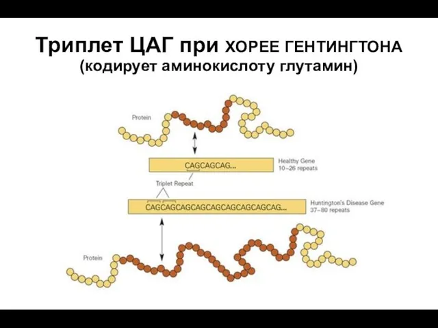 Триплет ЦАГ при ХОРЕЕ ГЕНТИНГТОНА (кодирует аминокислоту глутамин)