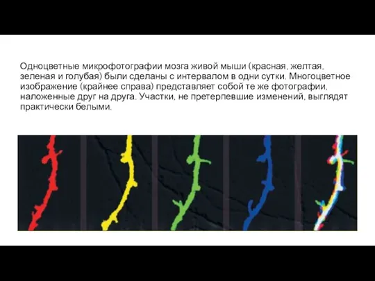 Одноцветные микрофотографии мозга живой мыши (красная, желтая, зеленая и голубая) были