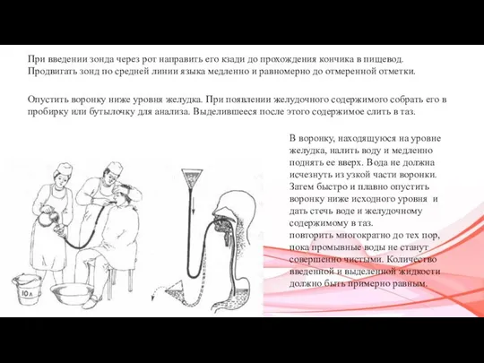 При введении зонда через рот направить его кзади до прохождения кончика