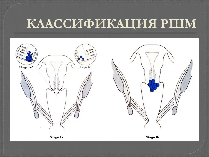 КЛАССИФИКАЦИЯ РШМ