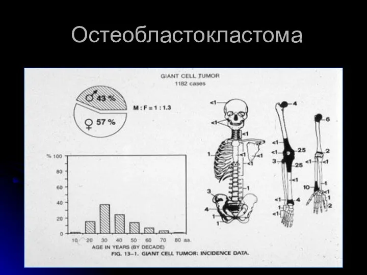 Остеобластокластома