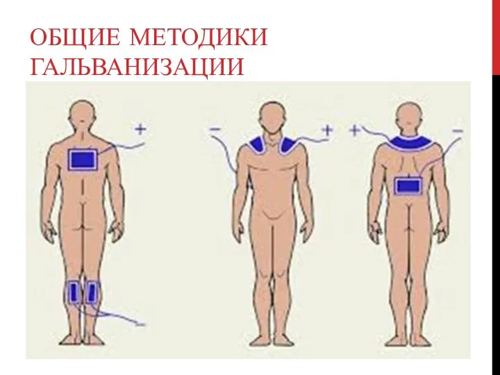 ОБЩИЕ МЕТОДИКИ ГАЛЬВАНИЗАЦИИ