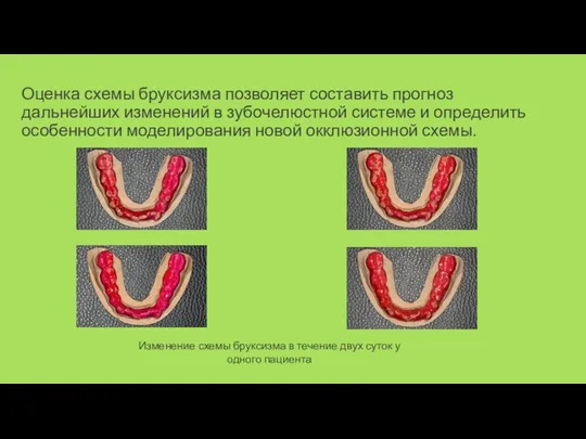 Оценка схемы бруксизма позволяет составить прогноз дальнейших изменений в зубочелюстной системе