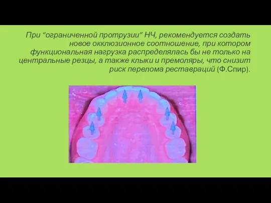 При “ограниченной протрузии” НЧ, рекомендуется создать новое окклюзионное соотношение, при котором