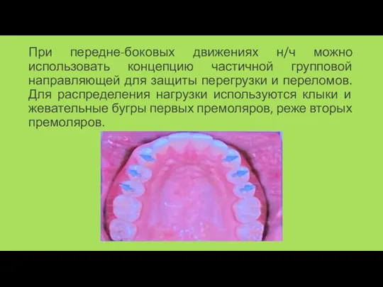 При передне-боковых движениях н/ч можно использовать концепцию частичной групповой направляющей для