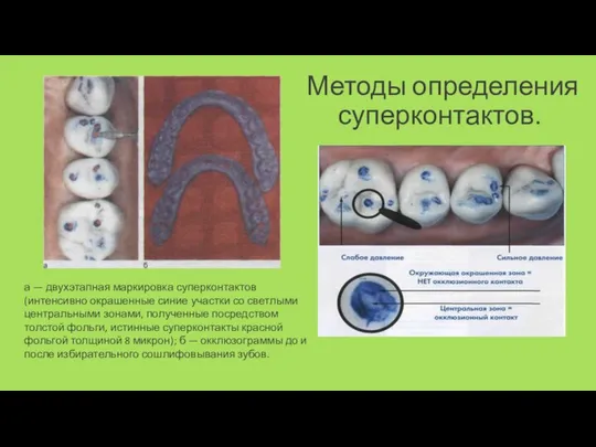 Методы определения суперконтактов. а — двухэтапная маркиров­ка суперконтактов (интенсивно окрашенные синие