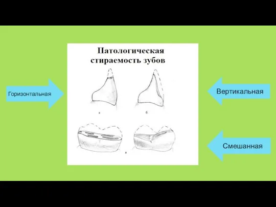 Горизонтальная Вертикальная Смешанная