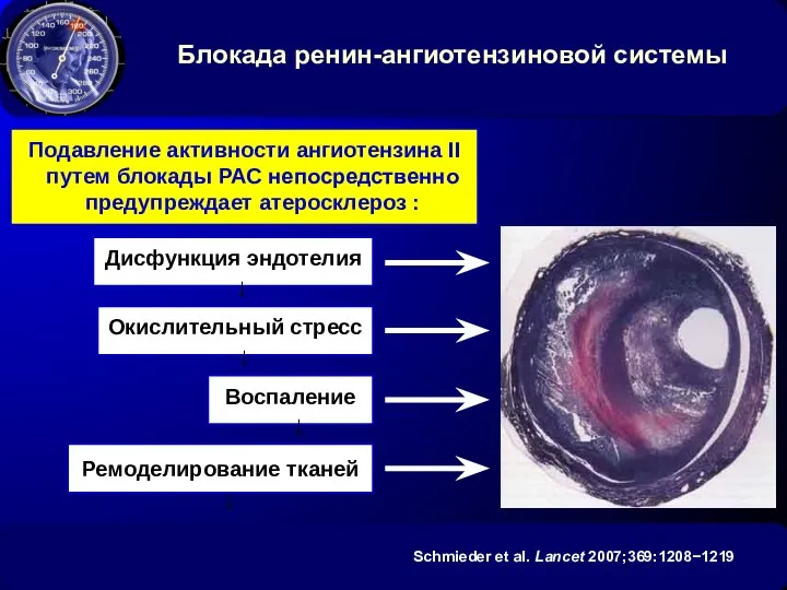 Блокада ренин-ангиотензиновой системы Окислительный стресс ↓ Воспаление ↓ Дисфункция эндотелия ↓