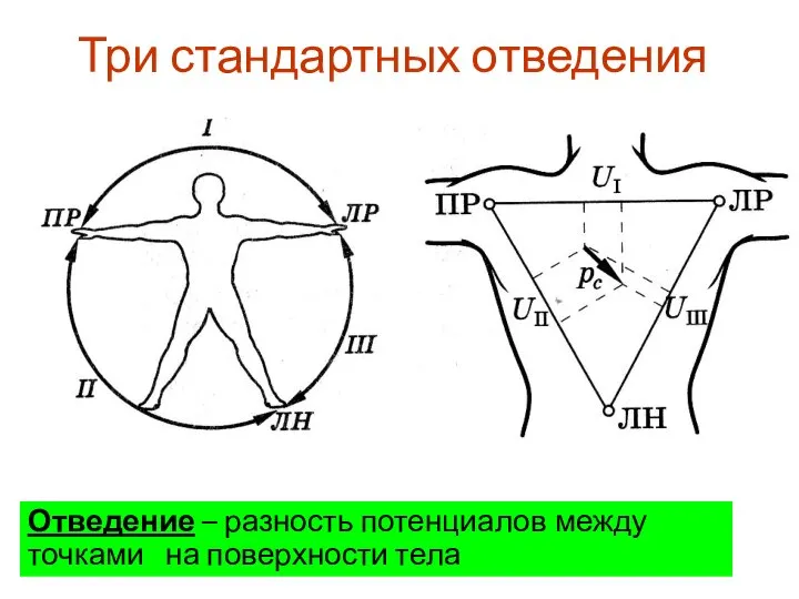 Три стандартных отведения Отведение – разность потенциалов между точками на поверхности тела