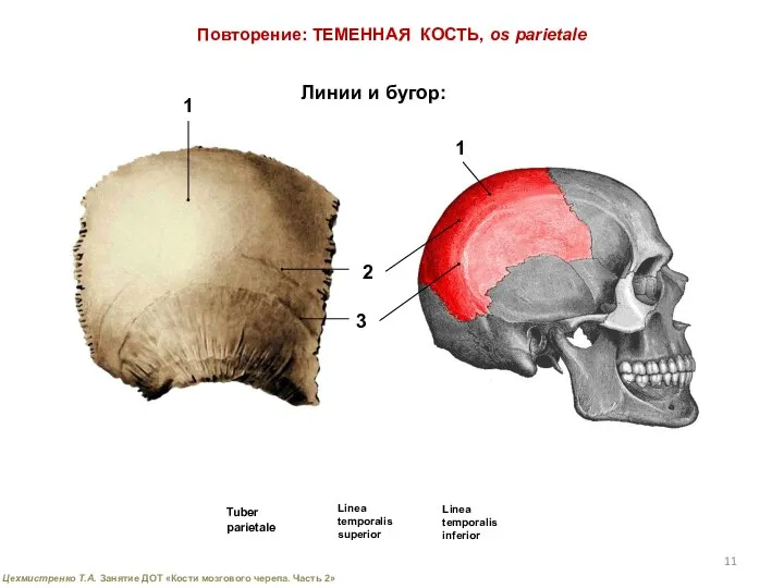 Повторение: ТЕМЕННАЯ КОСТЬ, os parietale Линии и бугор: 1 2 3