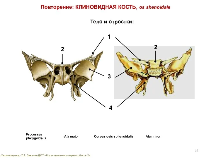 Повторение: КЛИНОВИДНАЯ КОСТЬ, os shenoidale Тело и отростки: 1 2 2