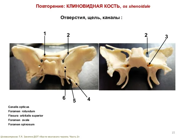 Повторение: КЛИНОВИДНАЯ КОСТЬ, os shenoidale Отверстия, щель, каналы : 1 Canalis