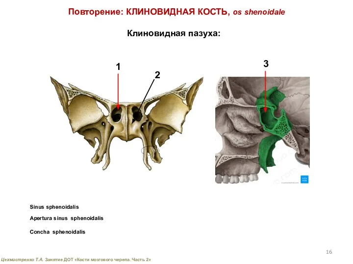 Повторение: КЛИНОВИДНАЯ КОСТЬ, os shenoidale Клиновидная пазуха: Apertura sinus sphenoidalis Sinus