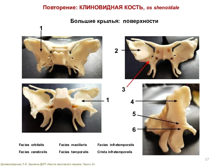 Повторение: КЛИНОВИДНАЯ КОСТЬ, os shenoidale Большие крылья: поверхности Facies orbitalis Facies