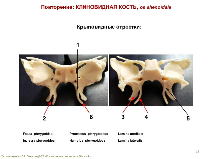 Повторение: КЛИНОВИДНАЯ КОСТЬ, os shenoidale Крыловидные отростки: Fossa pterygoidea Incisura pterygoidea