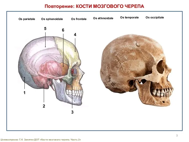 Повторение: КОСТИ МОЗГОВОГО ЧЕРЕПА 1 Os parietale Os sphenoidale Os frontale