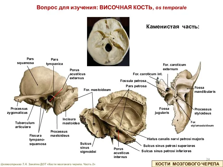 КОСТИ МОЗГОВОГО ЧЕРЕПА Pars petrosa Processus mastoideus For. mastoideum Pars tympanica