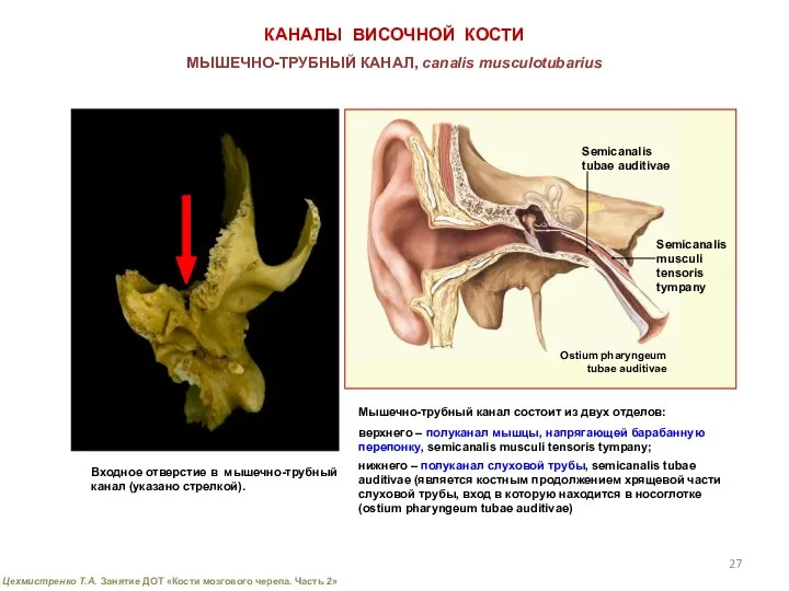 КАНАЛЫ ВИСОЧНОЙ КОСТИ МЫШЕЧНО-ТРУБНЫЙ КАНАЛ, canalis musculotubarius Входное отверстие в мышечно-трубный