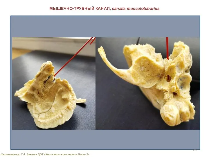 МЫШЕЧНО-ТРУБНЫЙ КАНАЛ, canalis musculotubarius Цехмистренко Т.А. Занятие ДОТ «Кости мозгового черепа. Часть 2»