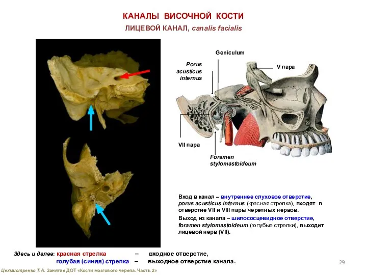 КАНАЛЫ ВИСОЧНОЙ КОСТИ ЛИЦЕВОЙ КАНАЛ, canalis facialis Вход в канал –