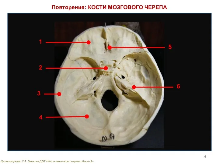 Повторение: КОСТИ МОЗГОВОГО ЧЕРЕПА 1 2 3 4 5 6 Цехмистренко