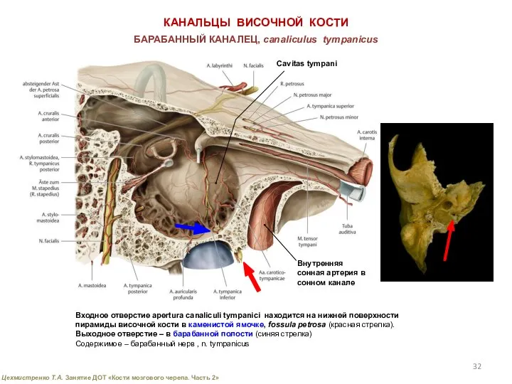 КАНАЛЬЦЫ ВИСОЧНОЙ КОСТИ Входное отверстие apertura canaliculi tympanici находится на нижней