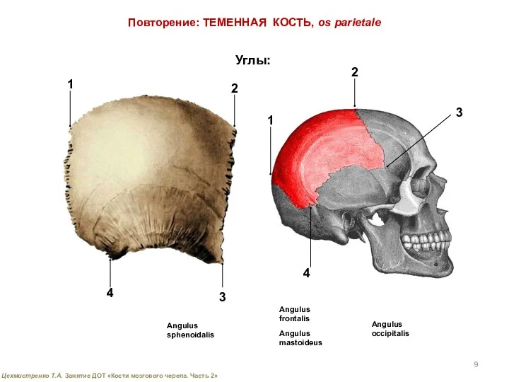 Повторение: ТЕМЕННАЯ КОСТЬ, os parietale Углы: Angulus occipitalis Angulus frontalis Angulus