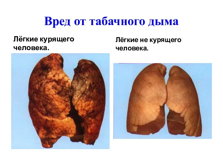 Вред от табачного дыма Лёгкие курящего человека. Лёгкие не курящего человека.