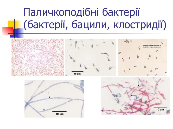 Паличкоподібні бактерії (бактерії, бацили, клостридії)