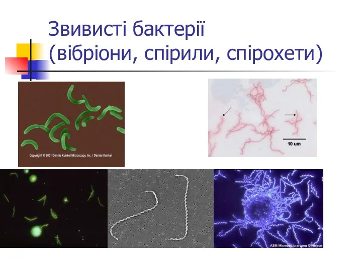 Звивисті бактерії (вібріони, спірили, спірохети)