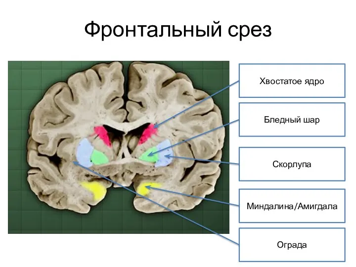 Фронтальный срез Хвостатое ядро Бледный шар Миндалина/Амигдала Скорлупа Ограда