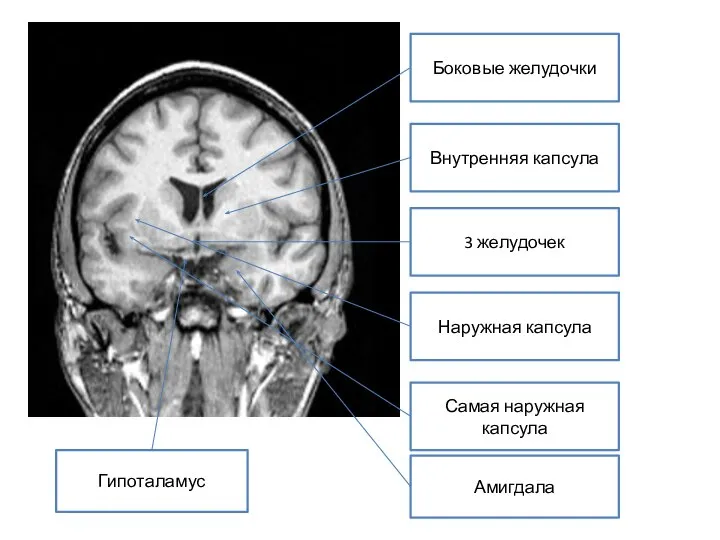 3 желудочек Боковые желудочки Внутренняя капсула Наружная капсула Самая наружная капсула Амигдала Гипоталамус