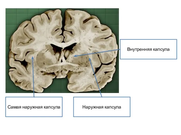 Внутренняя капсула Самая наружная капсула Наружная капсула