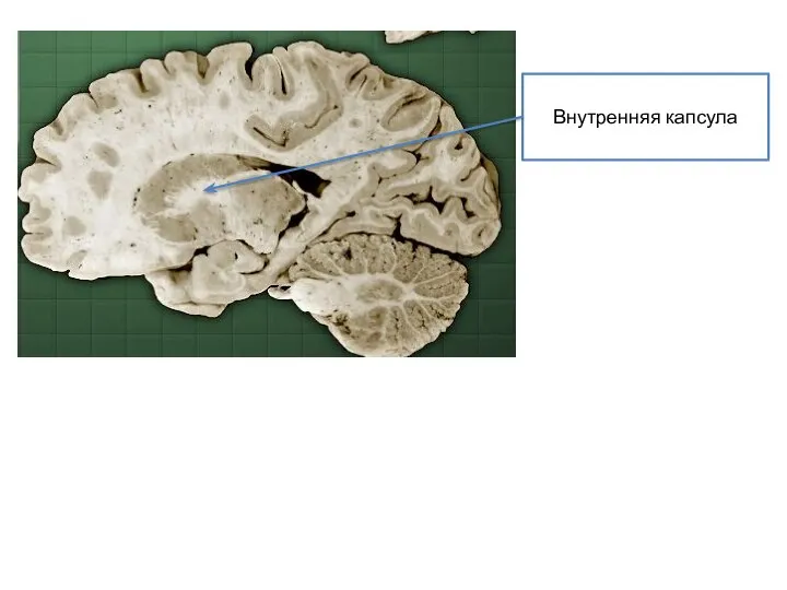 Внутренняя капсула