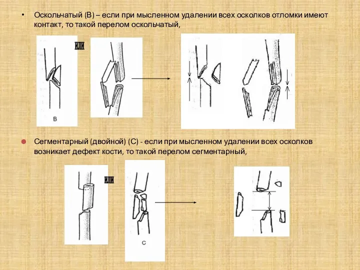 Оскольчатый (В) – если при мысленном удалении всех осколков отломки имеют