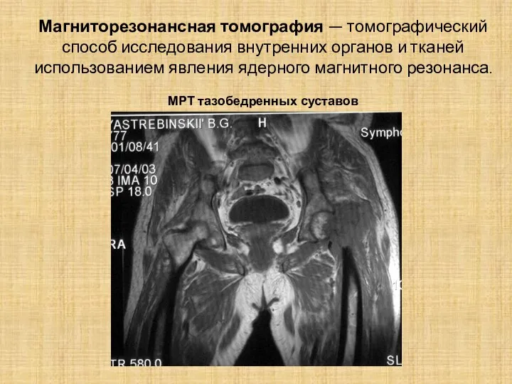 Магниторезонансная томография — томографический способ исследования внутренних органов и тканей использованием