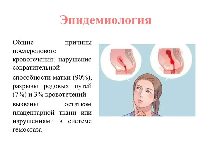 Эпидемиология Общие причины послеродового кровотечения: нарушение сократительной способности матки (90%), разрывы