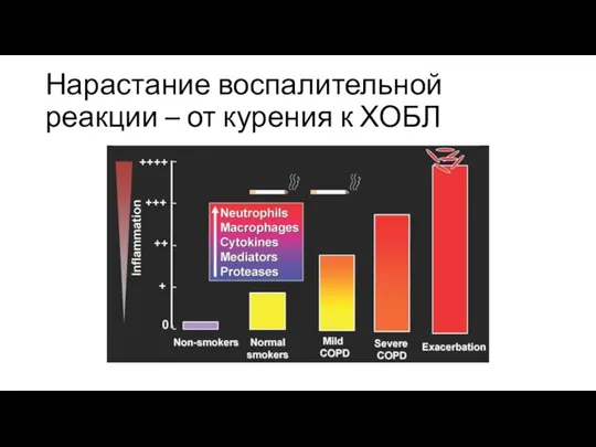 Нарастание воспалительной реакции – от курения к ХОБЛ