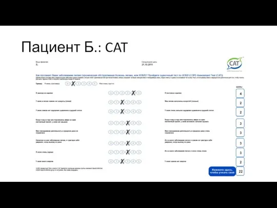 Пациент Б.: CAT