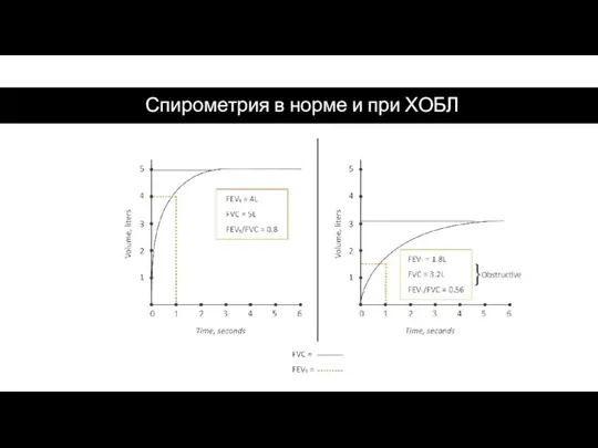 Спирометрия в норме и при ХОБЛ