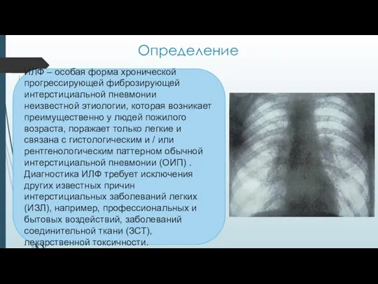 Определение ИЛФ – особая форма хронической прогрессирующей фиброзирующей интерстициальной пневмонии неизвестной