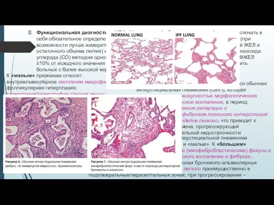 Функциональная диагностика ИЛФ. Минимальный объем исследований должен включать в себя обязательное