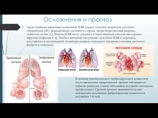 Осложнения и прогноз Среди наиболее вероятных осложнений ИЛФ следует отметить вторичную