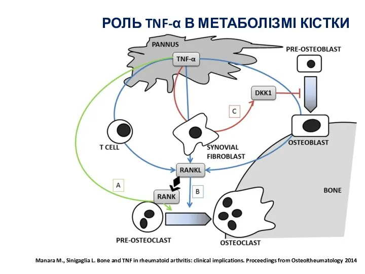 Manara M., Sinigaglia L. Bone and TNF in rheumatoid arthritis: clinical