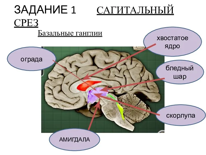 ЗАДАНИЕ 1 САГИТАЛЬНЫЙ СРЕЗ хвостатое ядро скорлупа бледный шар ограда АМИГДАЛА Базальные ганглии